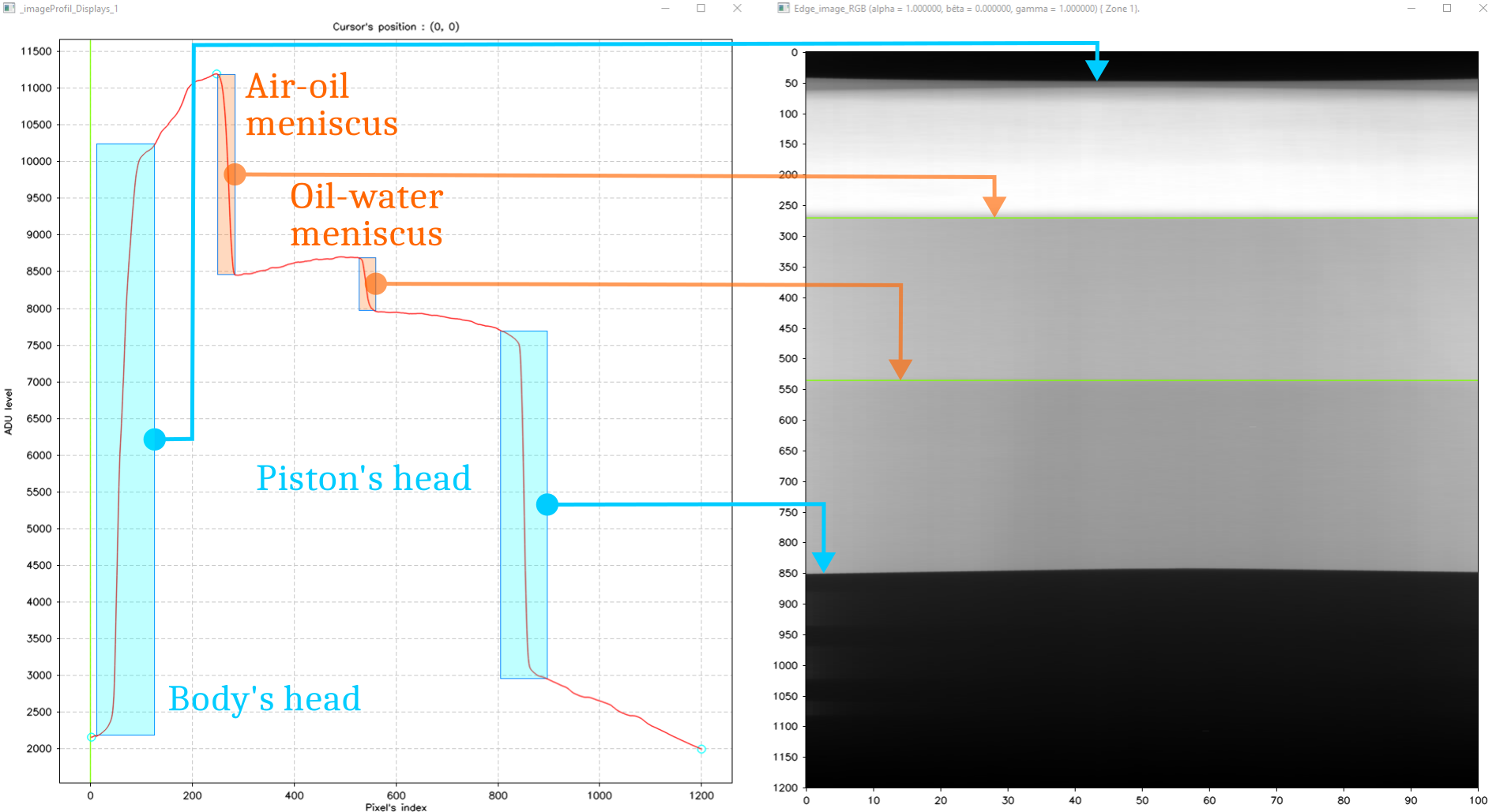 Détection de ménisque par traitement d'image (C++)